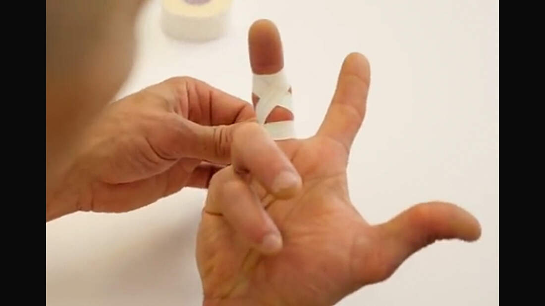 VideoTutorial Dr. Volker Schöffl Tapen fürs FingerMittelgelenk