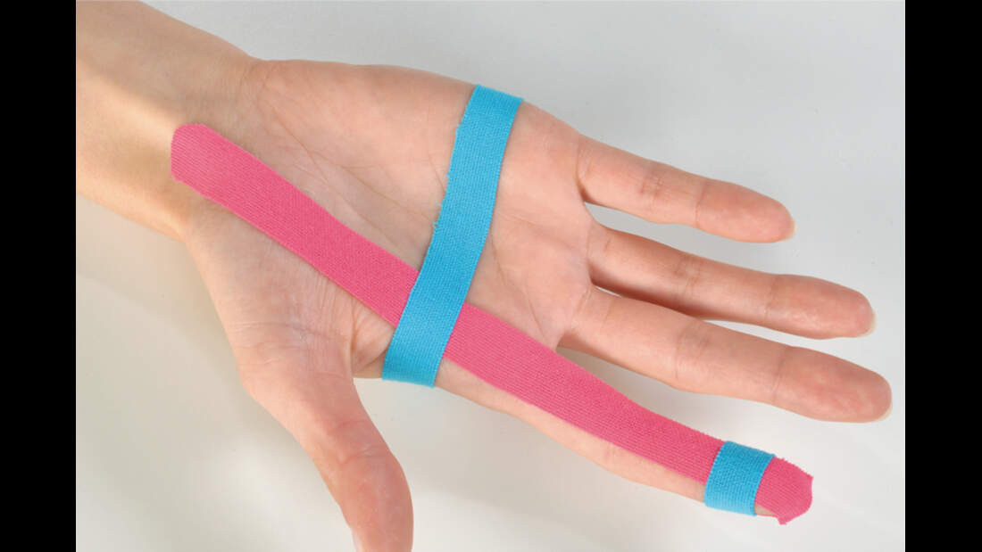 VideoTutorial Dr. Volker Schöffl Tapen fürs FingerMittelgelenk